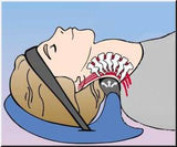 Cervical Traction Posture Pump 1100 - Cervical Traction Device