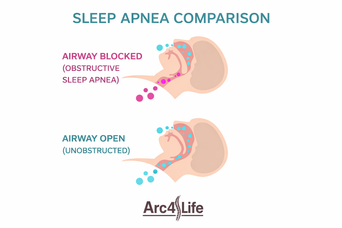 Sleep Apnea Symptoms in Women: Why They’re Often Missed and What to Watch For