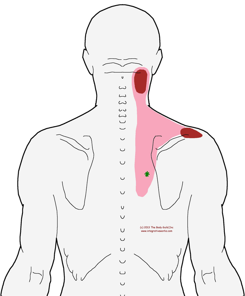 Pain in the Left Side of the Neck