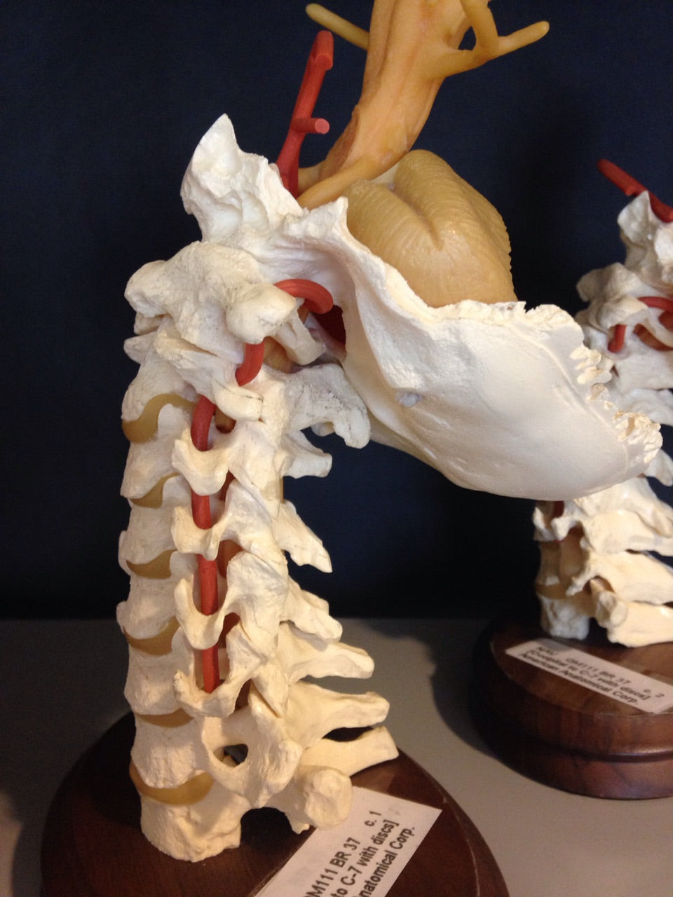 Does this Pillow keep your head from falling to the side and stretching your neck when sleeping