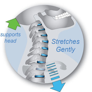 Neck Pain Due to a Herniated Disc and how to Handle it with a traction unit