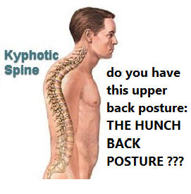 Hunchback Posture and How It Affects Your Neck