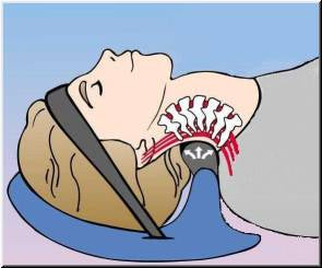 Cervical Traction Posture Pump 1100 - Cervical Traction Device